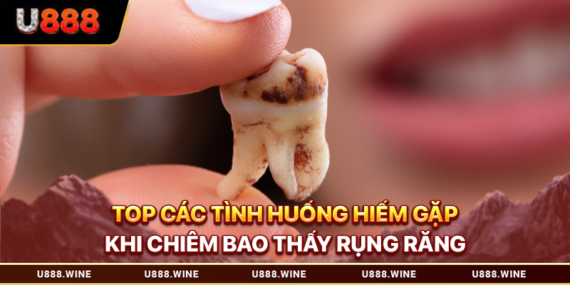 Top các tình huống hiếm gặp khi chiêm bao thấy rụng răng 